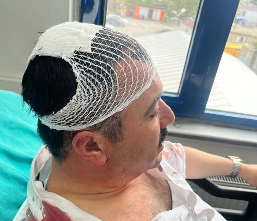 Dulkadiroğlu Belediye Başkan Yardımcısı Latif Öztürk, makamında saldırıya uğradı. Olayın